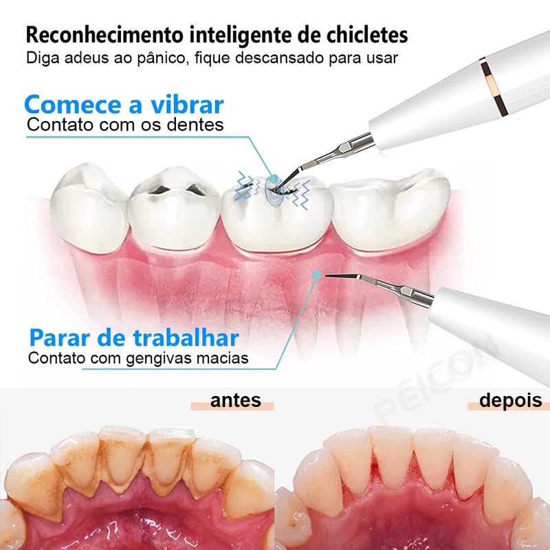 Limpador De Dentes Elétrico Ultrassônico