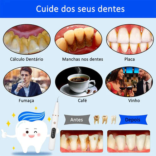 Limpador De Dentes Elétrico Ultrassônico