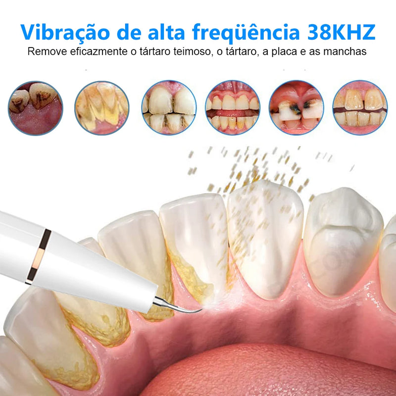 Limpador De Dentes Elétrico Ultrassônico